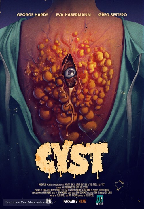 Cyst - Movie Poster