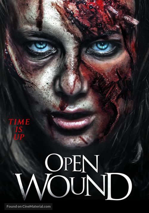 Open Wound: The &Uuml;ber-Movie - Video on demand movie cover