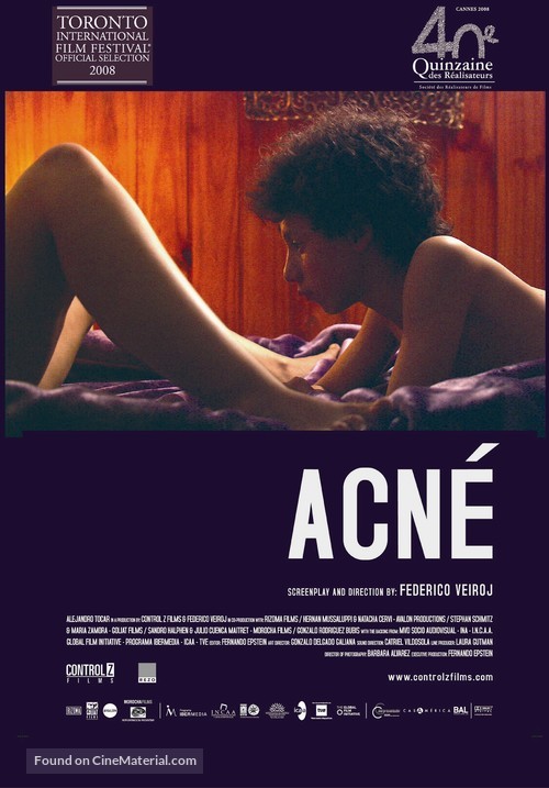 Acn&eacute; - Movie Poster